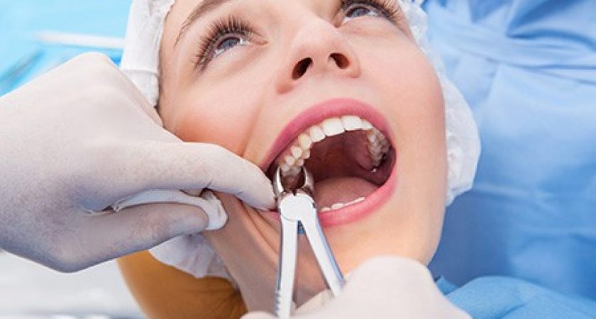 Laying To Rest Some Common Misconceptions About Wisdom Teeth